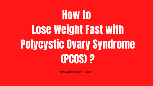 How to lose weight fast with PCOS?