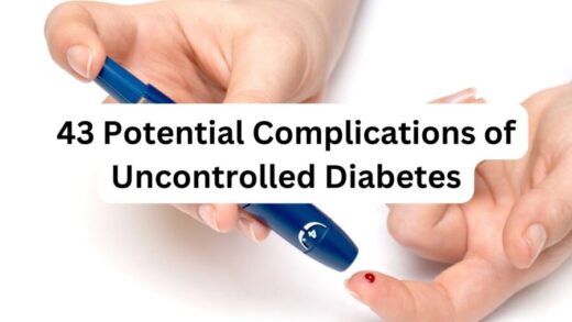 43 Potential Complications of Uncontrolled Diabetes