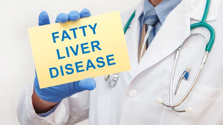 Nonalcoholic Fatty Liver Disease- A Potential Complication of Uncontrolled Diabetes