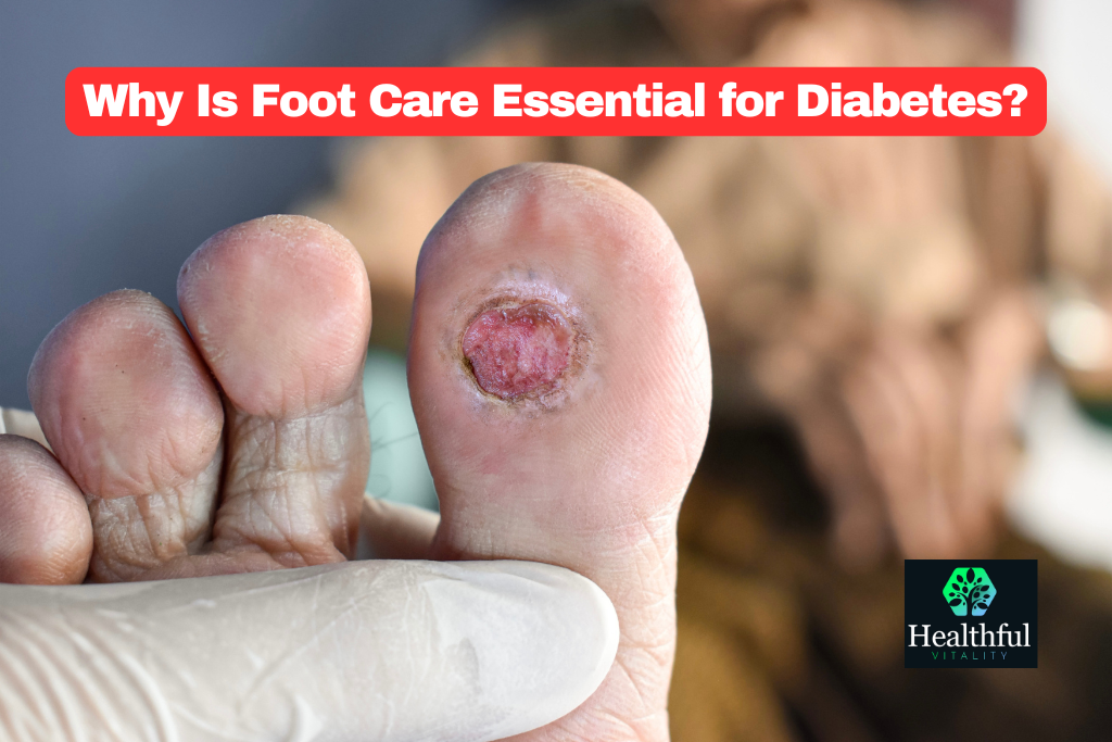 A close-up image of a diabetic foot ulcer, showing a deep wound on the sole due to complications from diabetes.